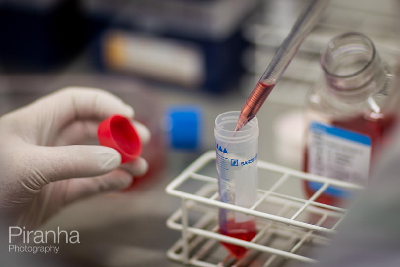 Medical Research Photography at the Rayne Institute in London 1 photograph of samples being taken in hospital