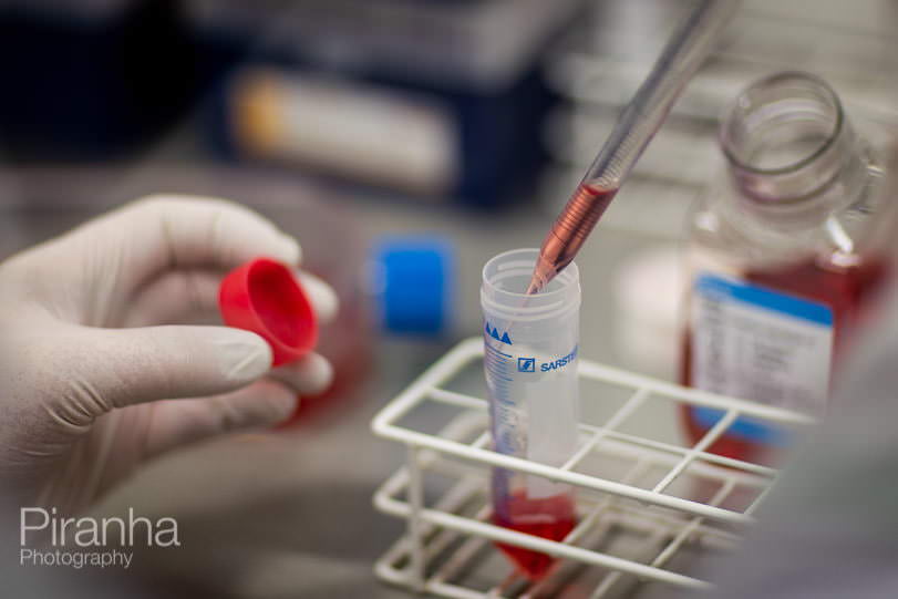 photograph of samples being taken in hospital