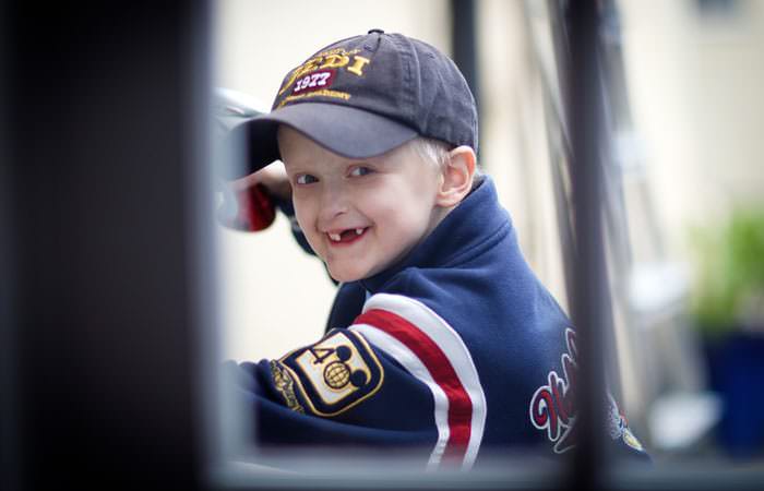 Photograph of child with disorder for charity