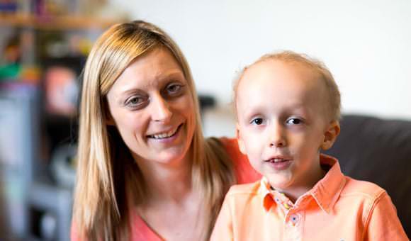 charity-photograph taken of children with genetic disorders 