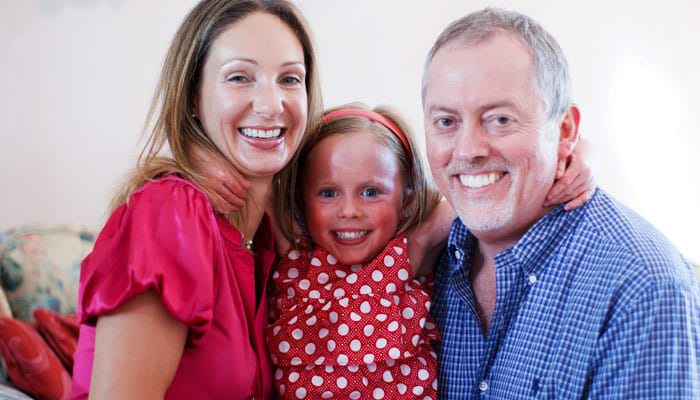 Jeans for Genes Ichthyosis sufferer Photography for Charity of Girl with Ichthyosis
